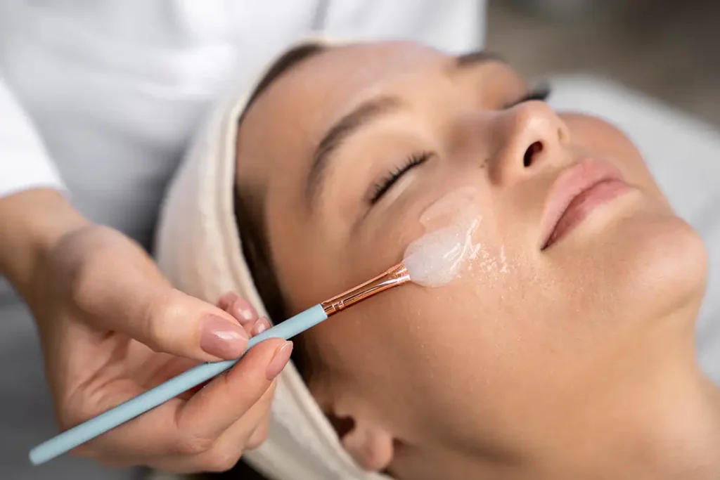 Skin Peels treatment